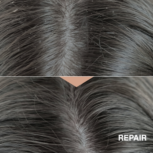 PDRN Repair Scalp Serum