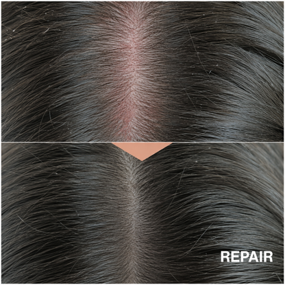 [Sensitive/Thinning] Repair + Lift Scalp Serum Duo 50ml(2ea)