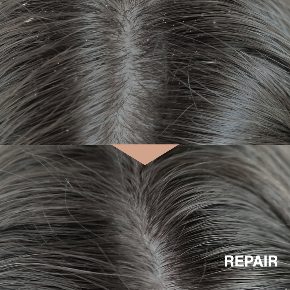 PDRN Repair Scalp Serum