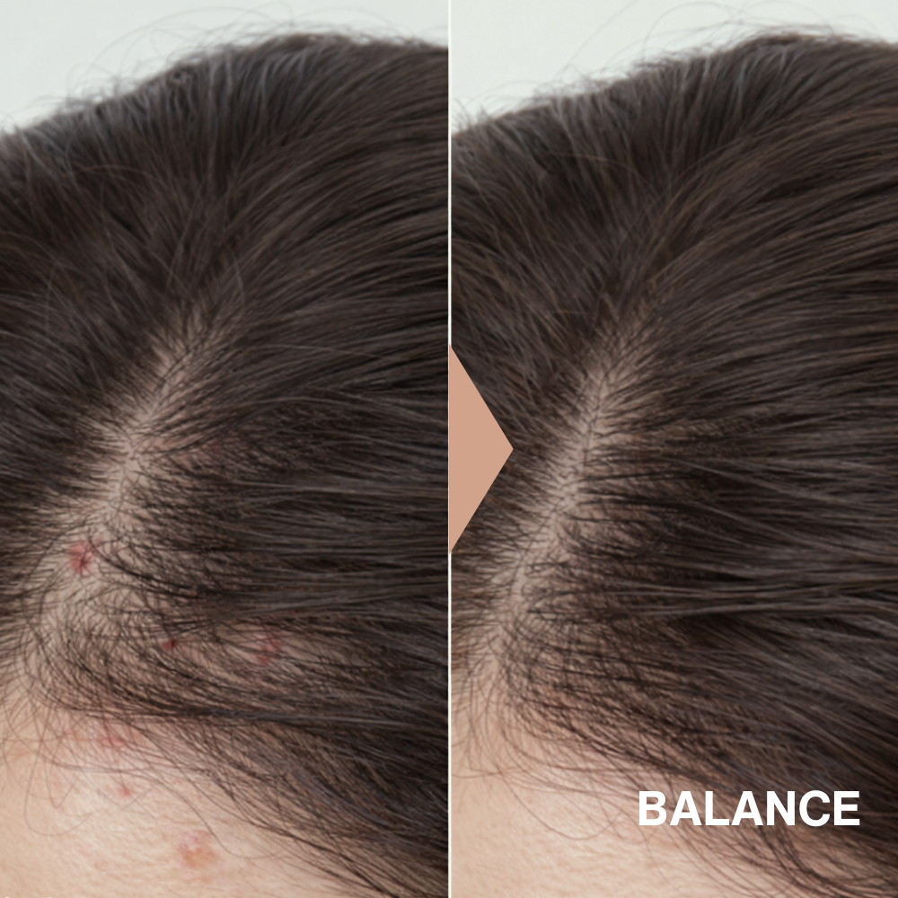 Rosemary Balance Scalp Serum