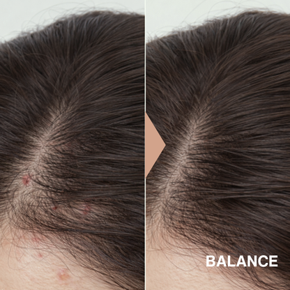 Rosemary Balance Scalp Serum