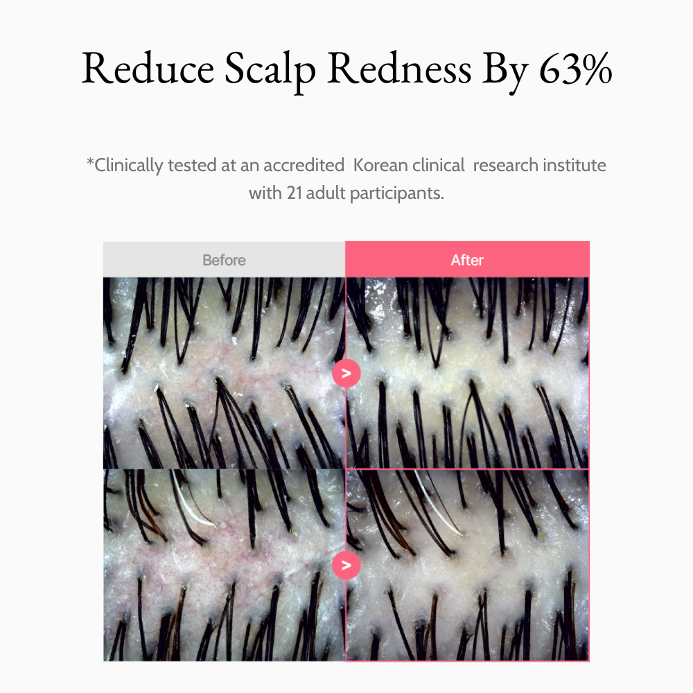 PDRN Repair Scalp Serum