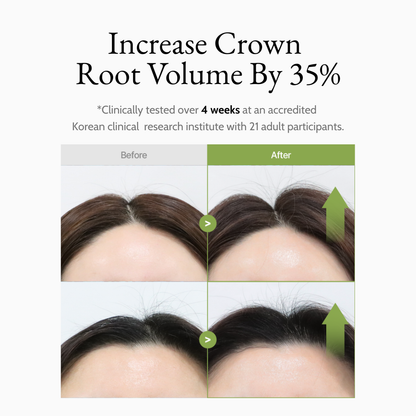 Brewer’s Yeast Lift Scalp Serum
