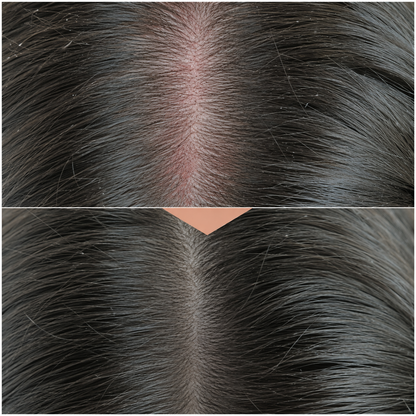 Repair Scalp Serum 50ml