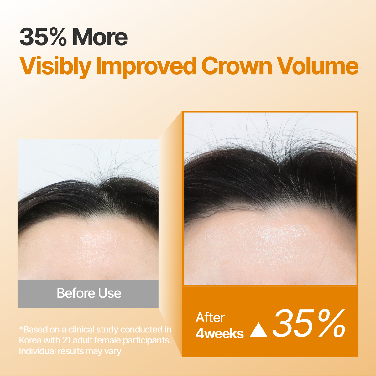 Oroot Lift Scalp Serum