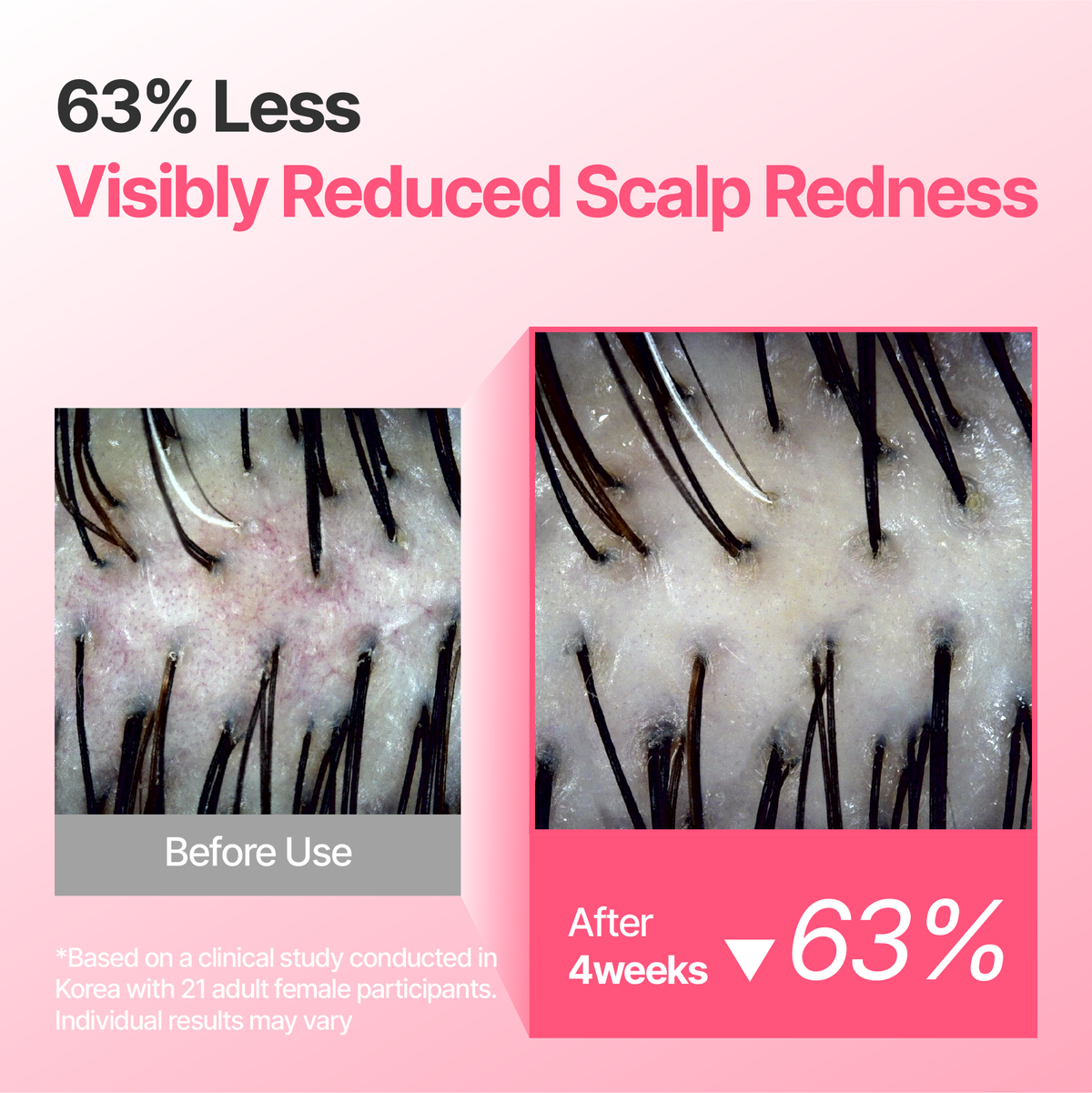 PDRN Repair Scalp Serum